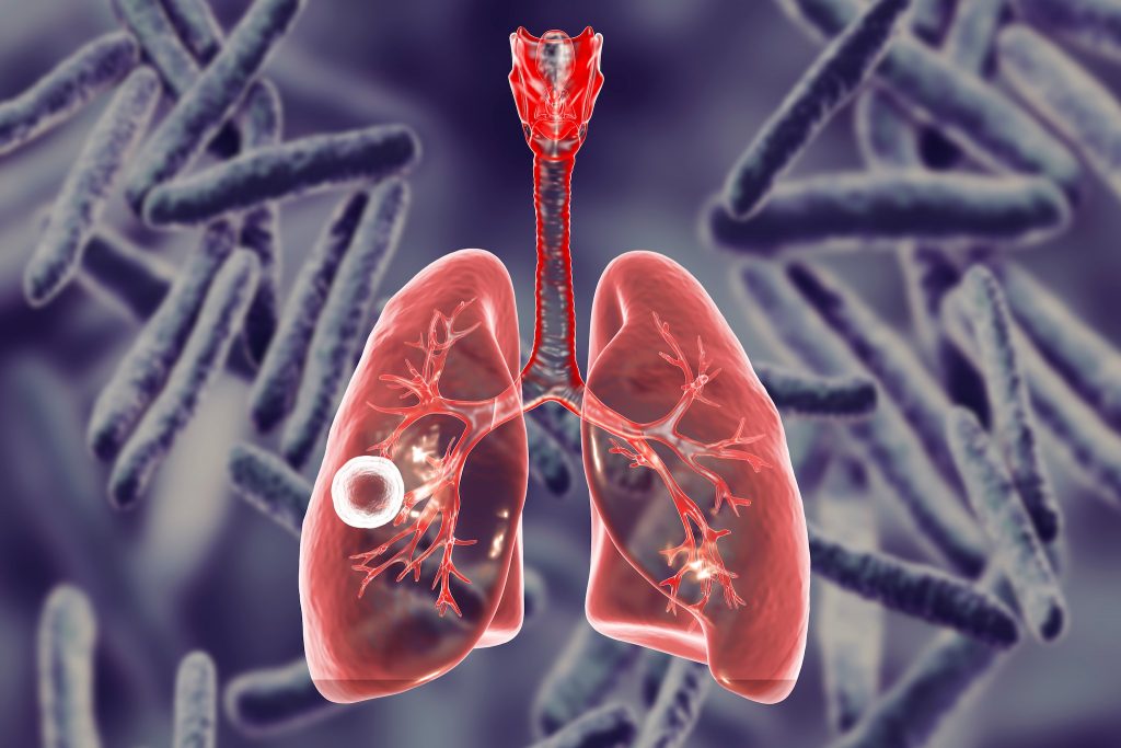 World Tuberculosis Day