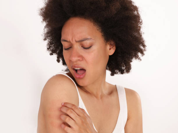 Shocking Ways Gluten Can Affect Your Skin