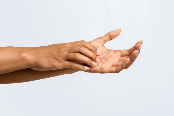 Shocking Ways Gluten Can Affect Your Skin