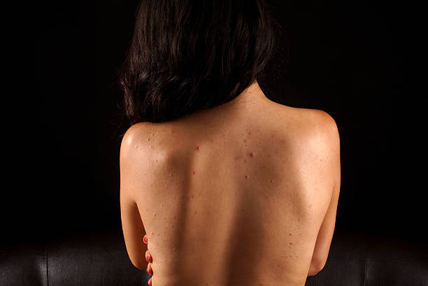 Shocking Ways Gluten Can Affect Your Skin